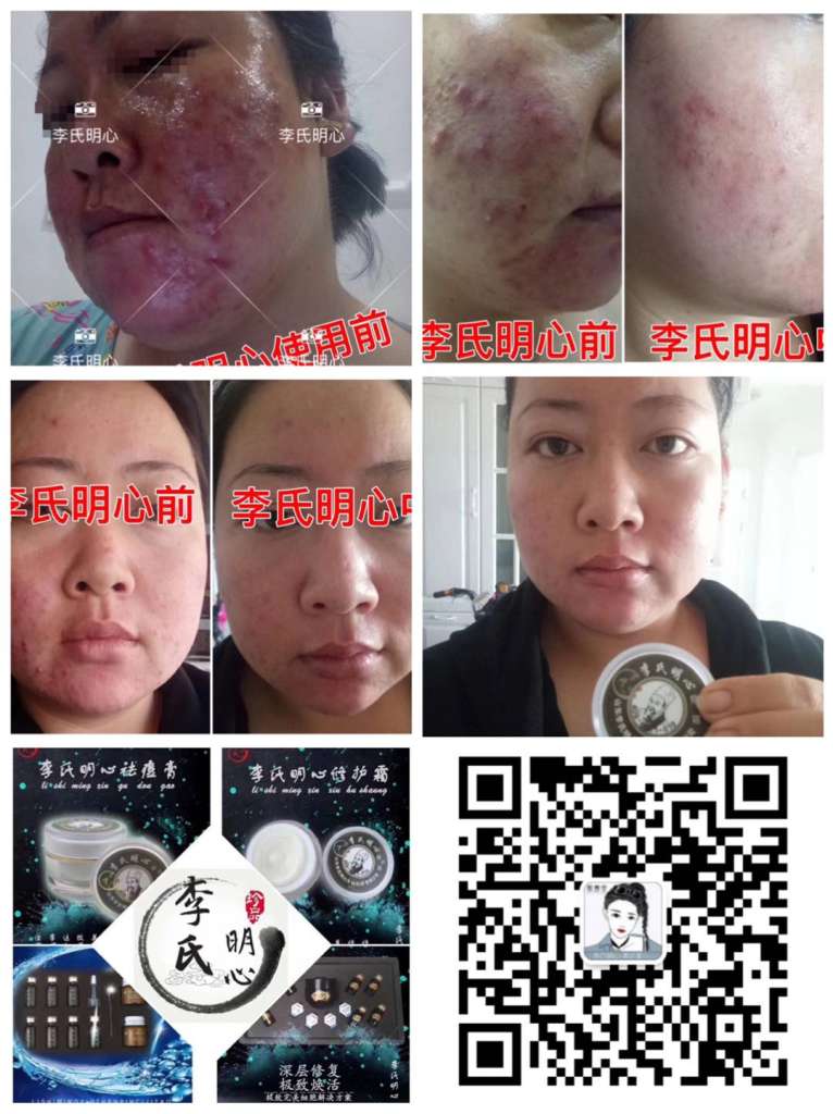 李氏明心修护霜美白效果好吗,什么时候上市的,市场前景如何